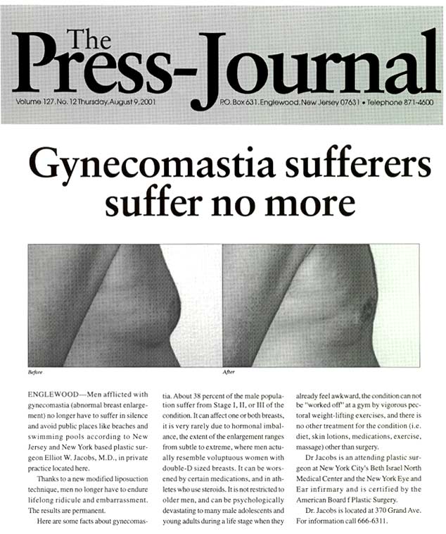 The Press Journal - Gynecomastia sufferers suffer no more