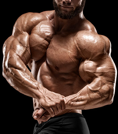 Gynecomastia in Bodybuilders